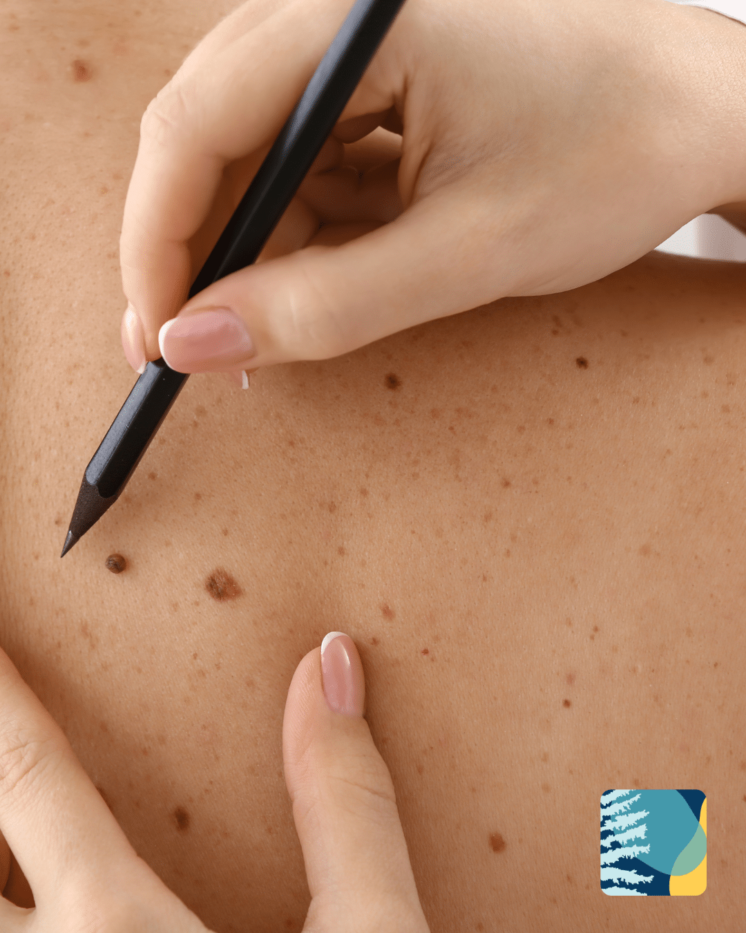 doctor-examining-skin-manly.png