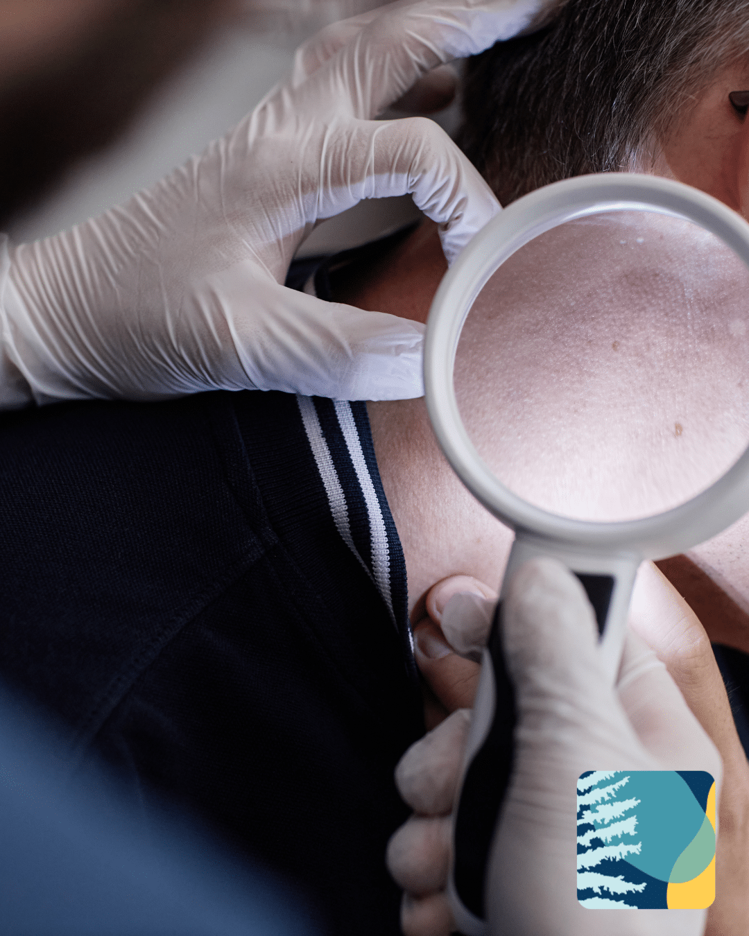 doctor-performing-mole-assessment.png