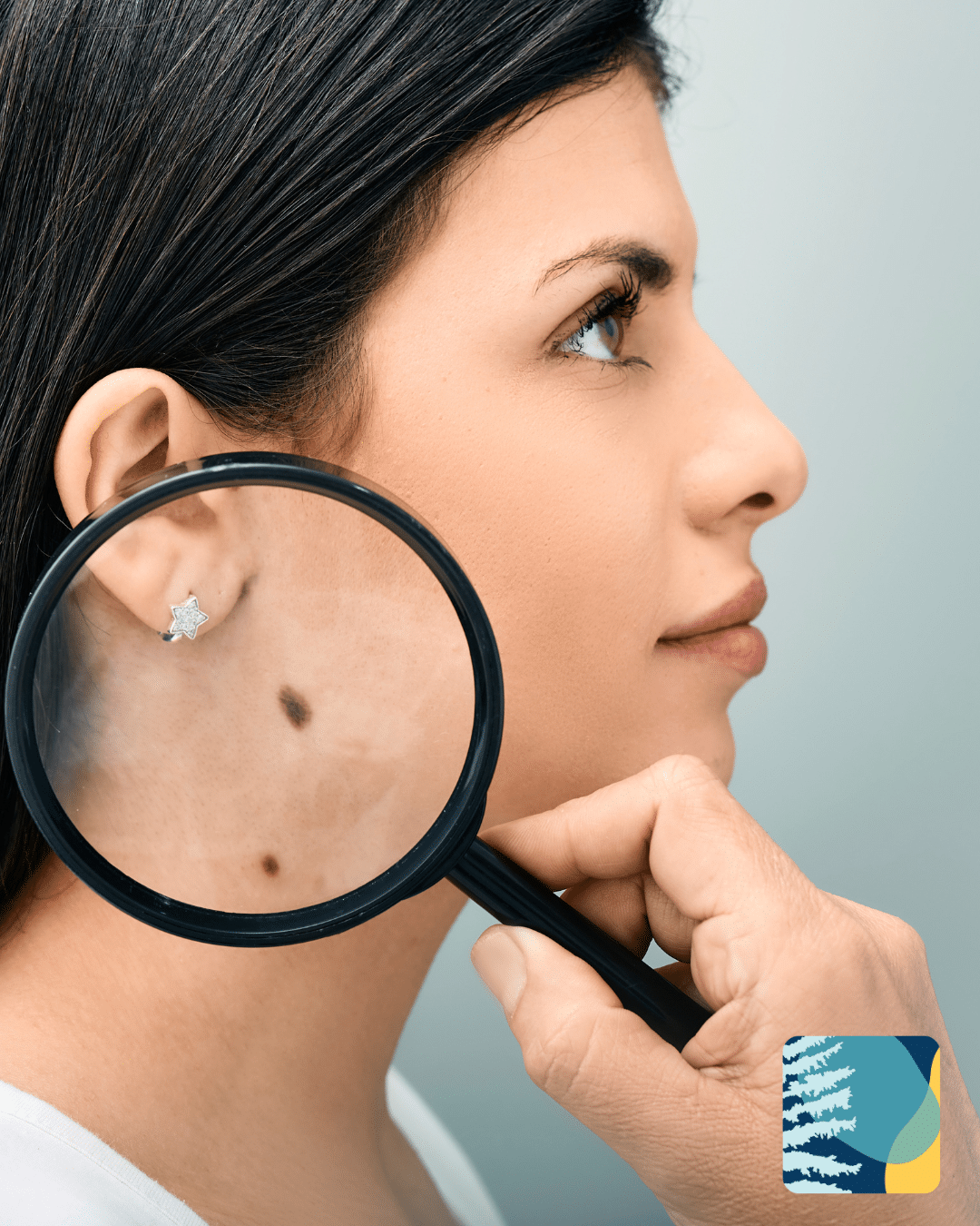 facial-skin-lesion-removal-manly.png